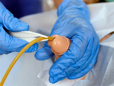 All the surgeons and other nurses I work with say to continue with the catheterization and that the erection facilitates the process. . Catheterization porn